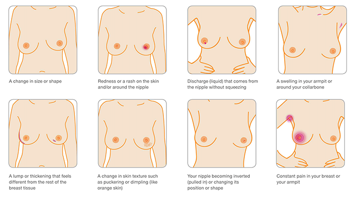 What Happens To Your Breast When You Become Pregnant 10